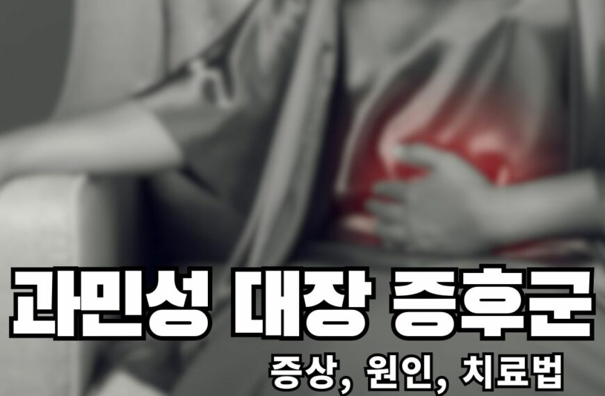 과민성 대장 증후군